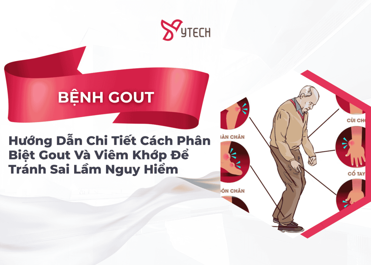 BỆNH GOUT (GÚT) LÀ GÌ? HƯỚNG DẪN CHI TIẾT CÁCH PHÂN BIỆT GOUT VÀ VIÊM KHỚP ĐỂ TRÁNH SAI LẦM NGUY HIỂM