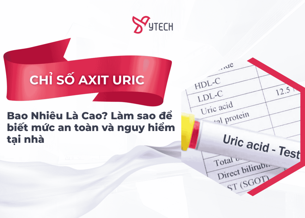 CHỈ SỐ AXIT URIC BAO NHIÊU LÀ CAO? LÀM SAO ĐỂ BIẾT MỨC AN TOÀN VÀ NGUY HIỂM TẠI NHÀ