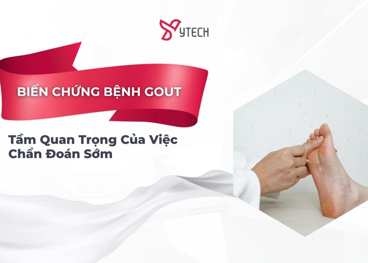 CẢNH BÁO BIẾN CHỨNG BỆNH GOUT NGUY HIỂM VÀ TẦM QUAN TRỌNG CỦA VIỆC CHẨN ĐOÁN SỚM