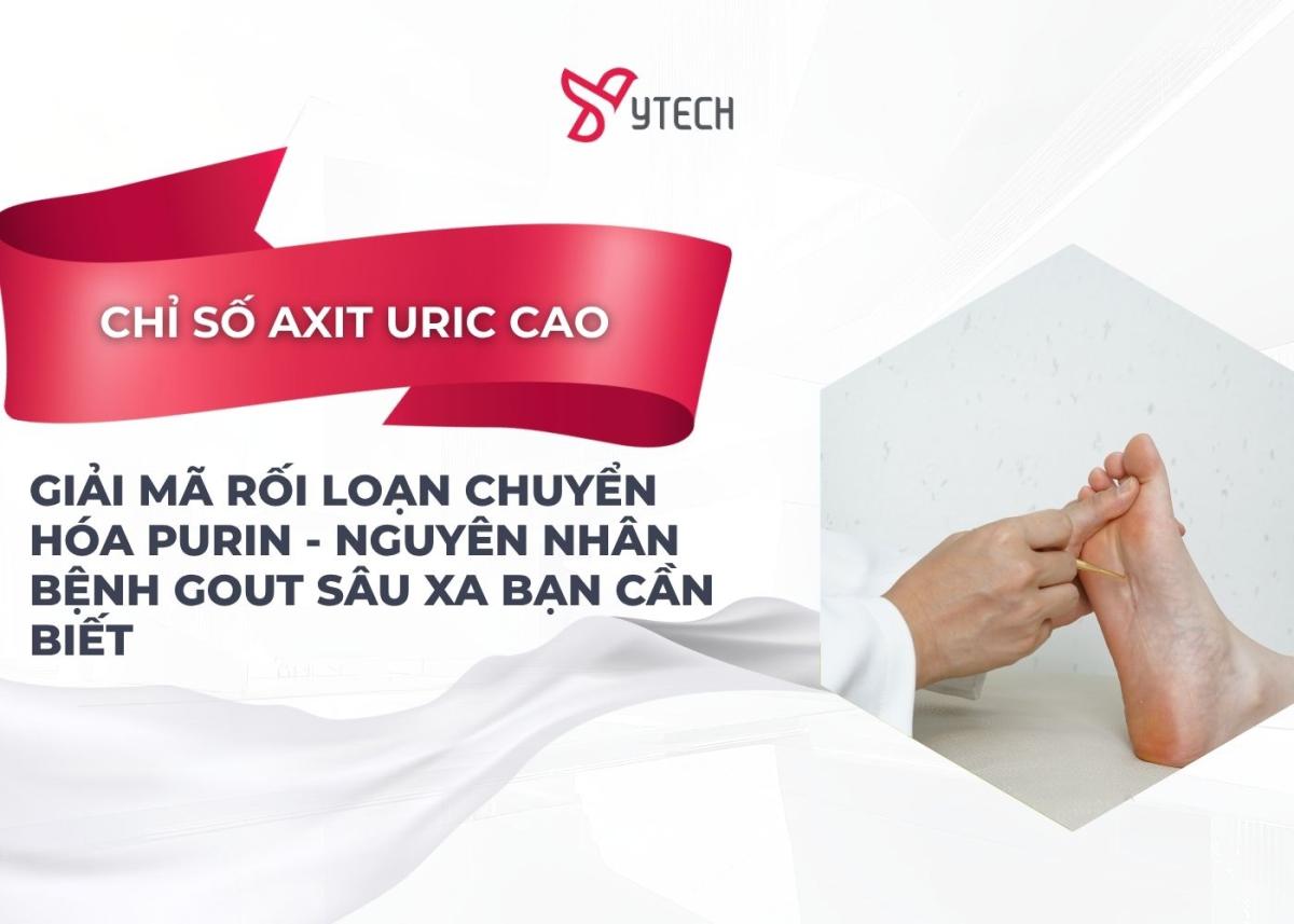 CHỈ SỐ AXIT URIC CAO GIẢI MÃ RỐI LOẠN CHUYỂN HÓA PURIN - NGUYÊN NHÂN BỆNH GOUT SÂU XA BẠN CẦN BIẾT