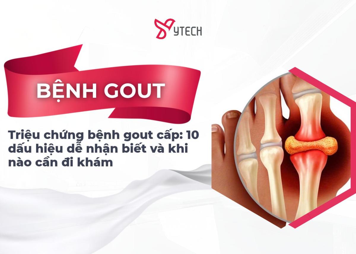 Triệu chứng bệnh gout cấp 10 dấu hiệu dễ nhận biết và khi nào cần đi khám