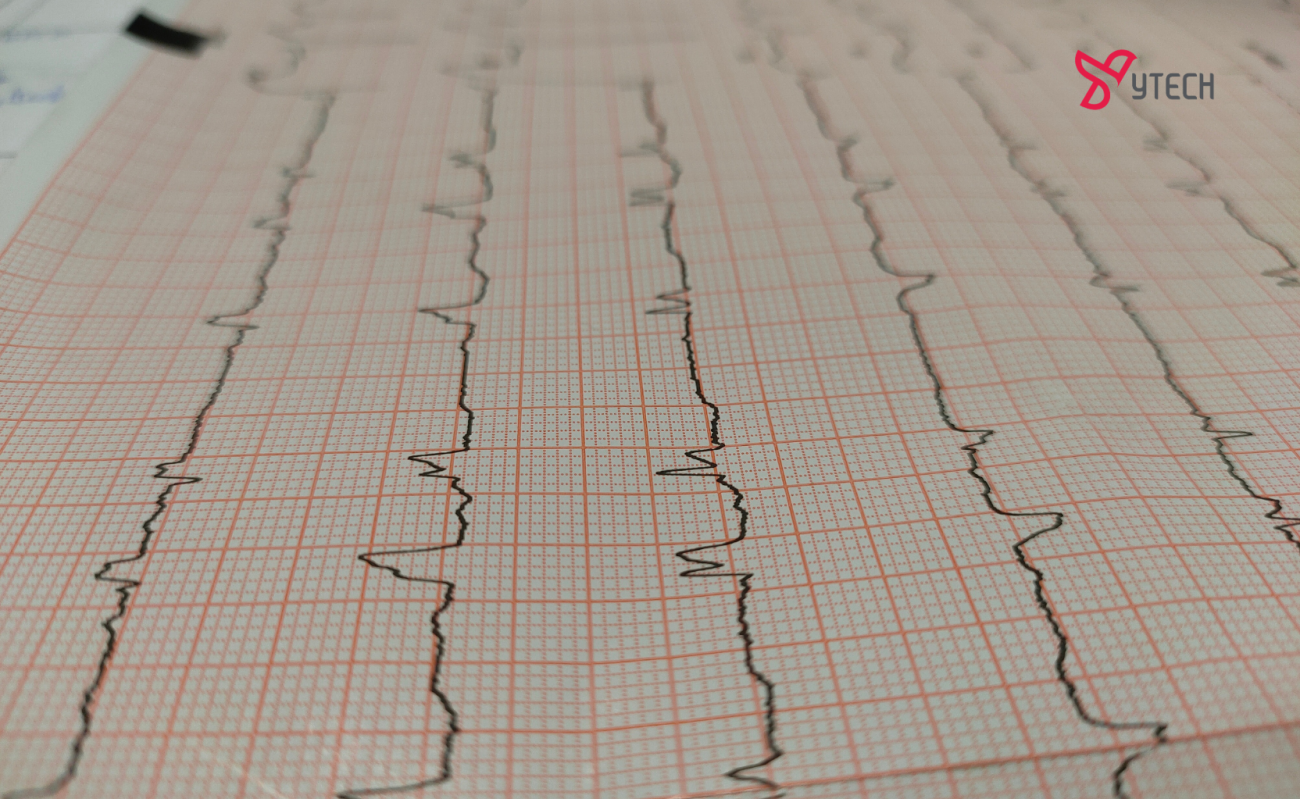 CÓ NÊN MUA THIẾT BỊ ĐO ĐIỆN TIM TẠI NHÀ? LỢI ÍCH VÀ LƯU Ý