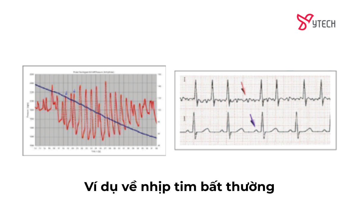 REVIEW CHI TIẾT CHỌN MÁY ĐO HUYẾT ÁP CHÍNH HÃNG CỦA THỤY SĨ LOẠI NÀO TỐT NHẤT HIỆN NAY?