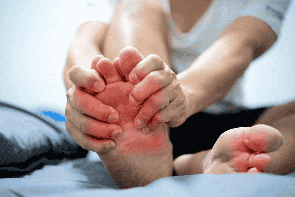 Bệnh gút gây đau ở các khớp, có xu hướng tái phát.