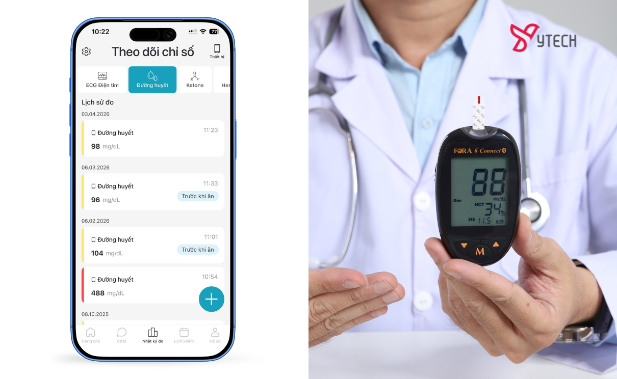 FORA 6 Connect là thiết bị được tin dùng nhất trên thị trường hiện nay