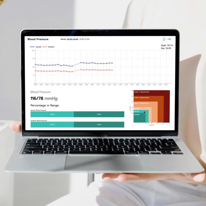 Corsano Cardiowatch 287-2 - Vòng đeo y tế theo dõi sức khỏe liên tục